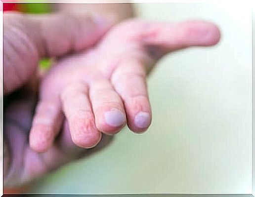 Blisters in children and how to treat them