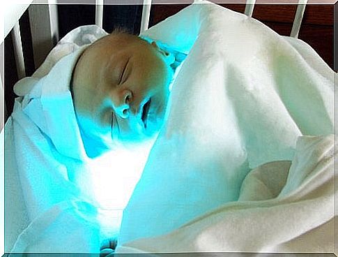 What is jaundice in infants and how is it treated?