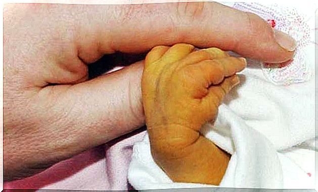 yellow skin on infants