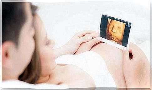 pregnant woman and man looking at ultrasound image